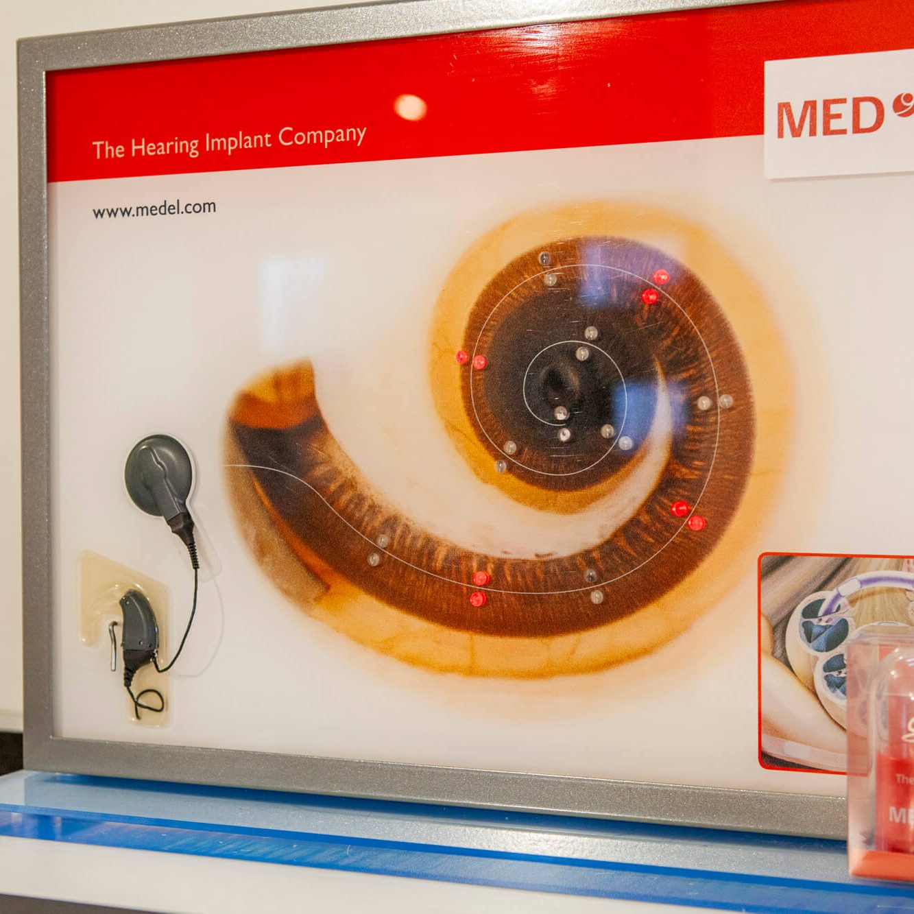 Model kochleárneho implantátu v Múzeu špeciálneho školstva v Levoči.